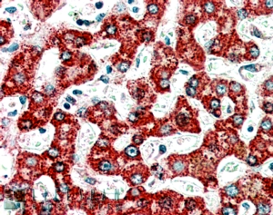 Goat Anti-ACADM Antibody