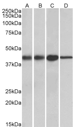 Goat Anti-ACAT1 (aa257-269) Antibody