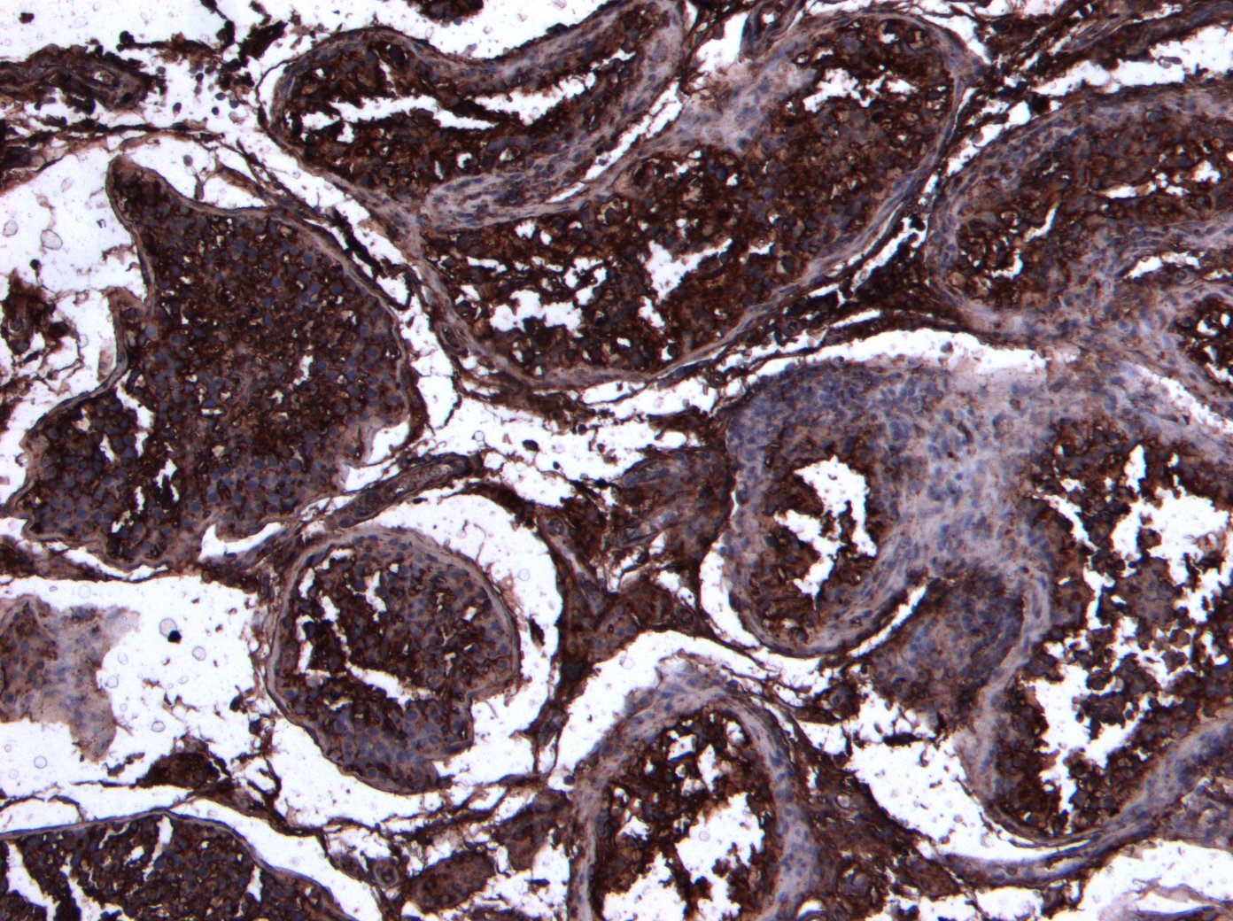 Goat Anti-ACE2 (N Terminal) Antibody