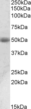 Goat Anti-ACPP / PAP (aa269-282), Biotinylated Antibody