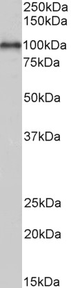 Goat Anti-ADAM12 (aa225-239) Antibody