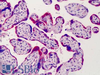 Goat Anti-ADAM12 Antibody