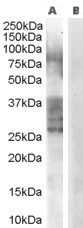 Goat Anti-ADAM33 Antibody