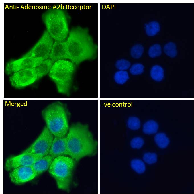 Goat Anti-Adenosine A2b Receptor Antibody