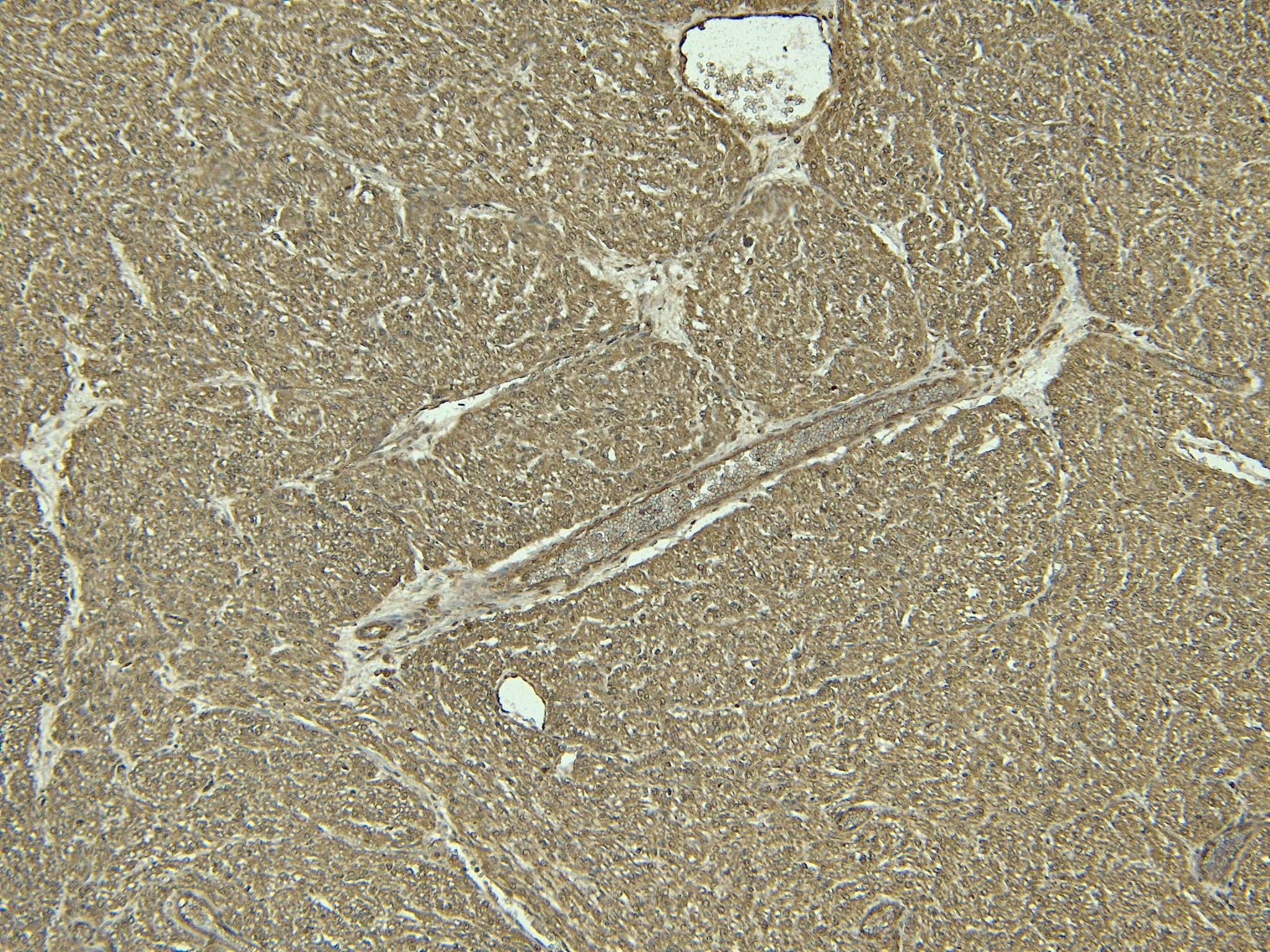 Goat Anti-ADRB1 Antibody