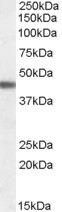 Goat Anti-ADRB3 Antibody