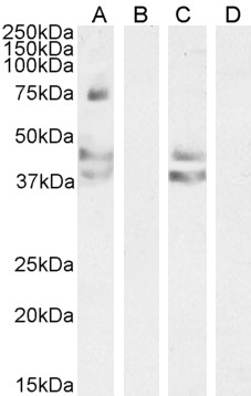 Goat Anti-AGTR1 / AT1 Antibody