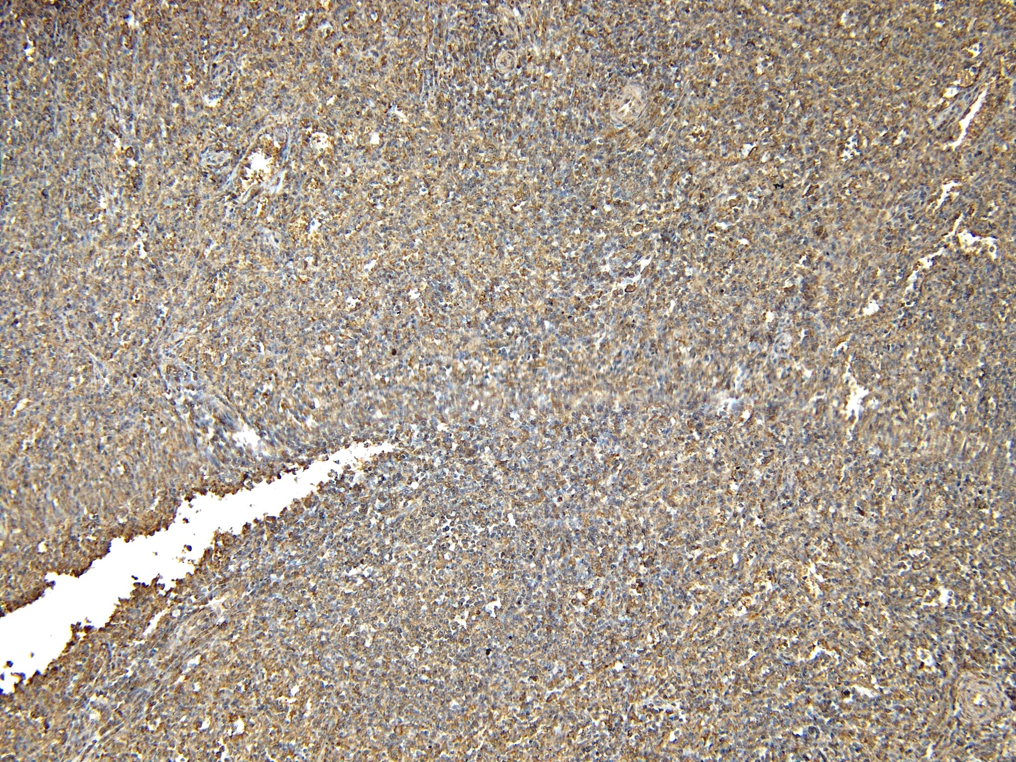 Goat Anti-AIF1 / IBA1 (isoform 3) Antibody