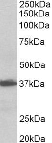 Goat Anti-AIMP1 /  SCYE1 (aa137-149), Biotinylated Antibody