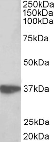 Goat Anti-AIMP1 /  SCYE1 Antibody