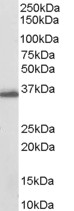 Goat Anti-AKR1C3 Antibody