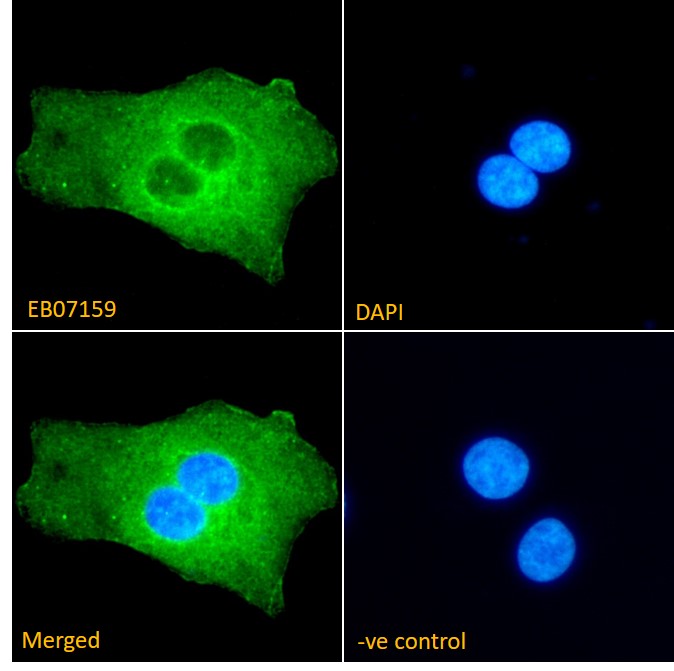 Goat Anti-AKT2 Antibody