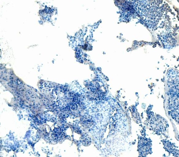 Goat Anti-AKT2 Antibody