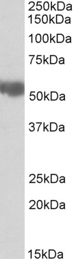 Goat Anti-ALDH3A2 Antibody
