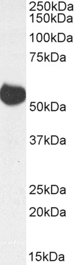 Goat Anti-ALDH5A1 (aa 485-496), Biotinylated Antibody