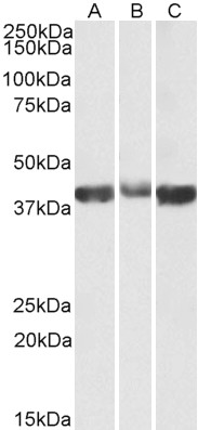 Goat Anti-ALDOA (aa86-96) Antibody