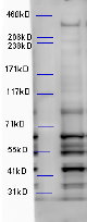 Goat Anti-Alfy / WDFY3 Antibody