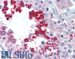 Goat Anti-ALK Antibody