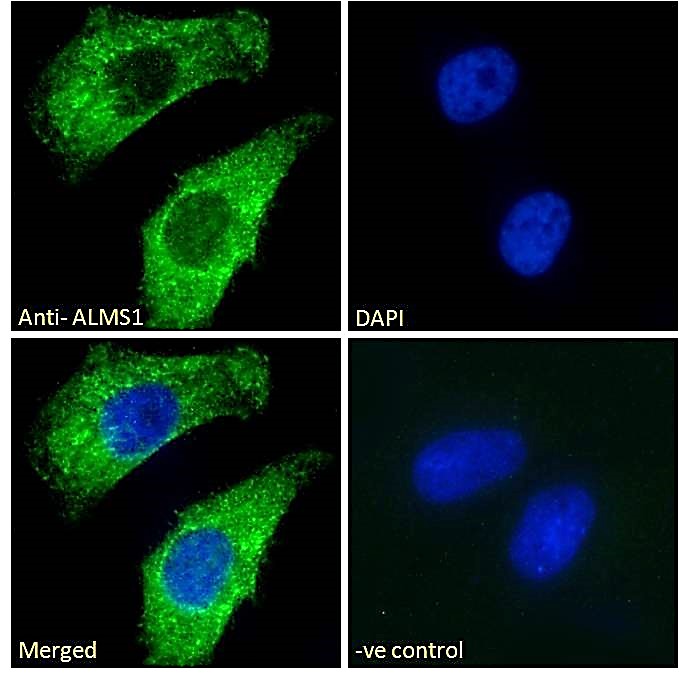 Goat Anti-ALMS1 Antibody