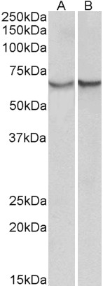 Goat Anti-alpha-1-antichymotrypsin (aa222-236) Antibody