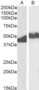 Goat Anti-alpha-1-antitrypsin (aa230-241) Antibody