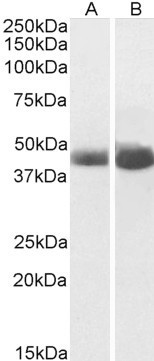 Goat Anti-alpha-1-antitrypsin Antibody