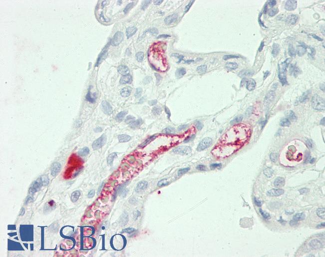 Goat Anti-alpha-2-macroglobulin Antibody