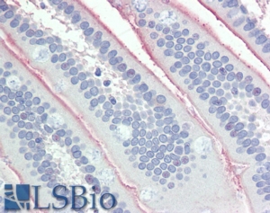 Goat Anti-ALPI  Antibody