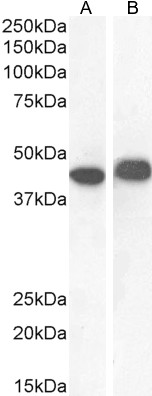 Goat Anti-AMACR (aa312-326) Antibody