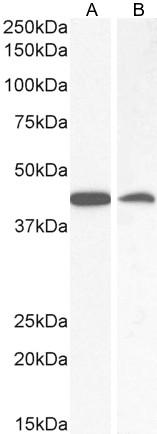 Goat Anti-AMACR Antibody