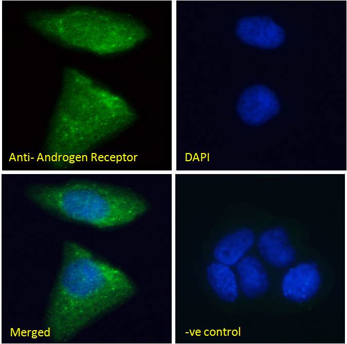 Goat Anti-Androgen Receptor Antibody