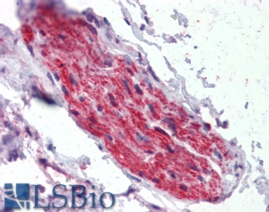 Goat Anti-Ankyrin G Antibody