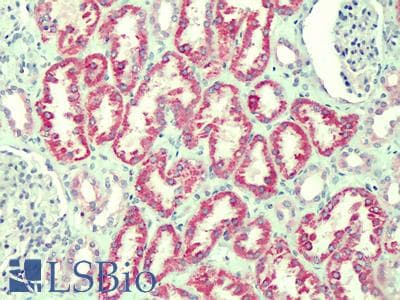 Goat Anti-ANTXR2 / CMG2 Antibody