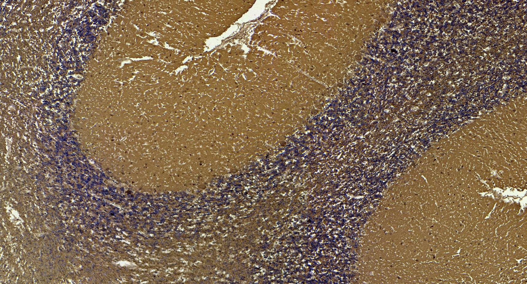 Goat Anti-AP2A1 (aa706-727) Antibody