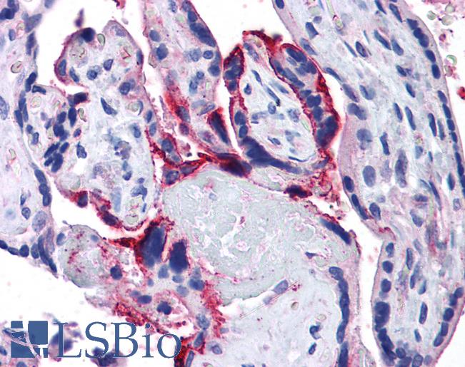 Goat Anti-APH1A Antibody