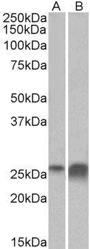 Goat Anti-APOD (aa70-80) Antibody
