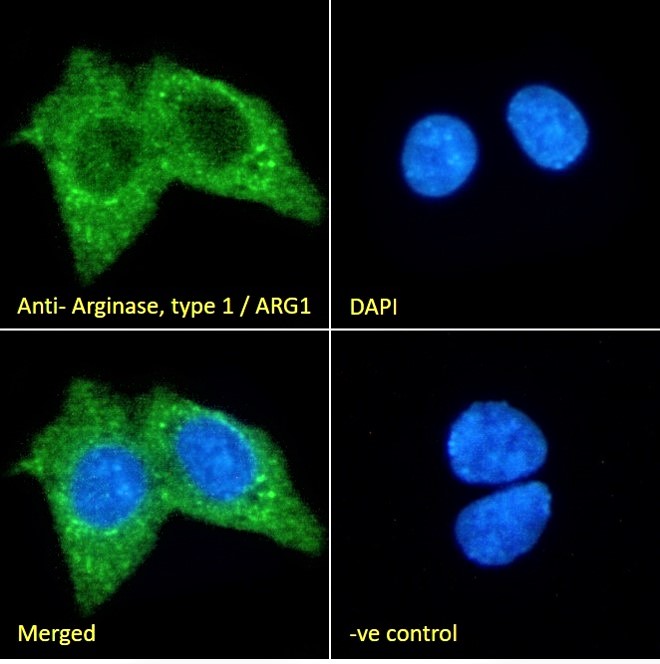 Goat Anti-Arginase, type 1 / ARG1 Antibody