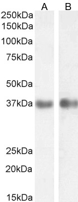Goat Anti-Arginase, type 1 / arg1(rat) Antibody