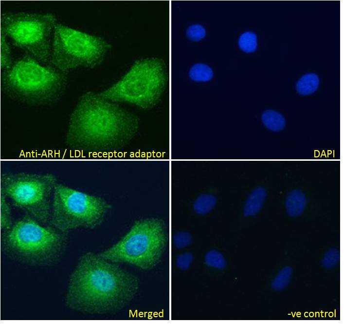 Goat Anti-ARH / LDL receptor adaptor Antibody
