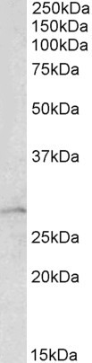 Goat Anti-ARHGDIA Antibody