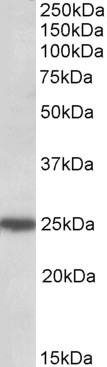 Goat Anti-ARHGDIG Antibody