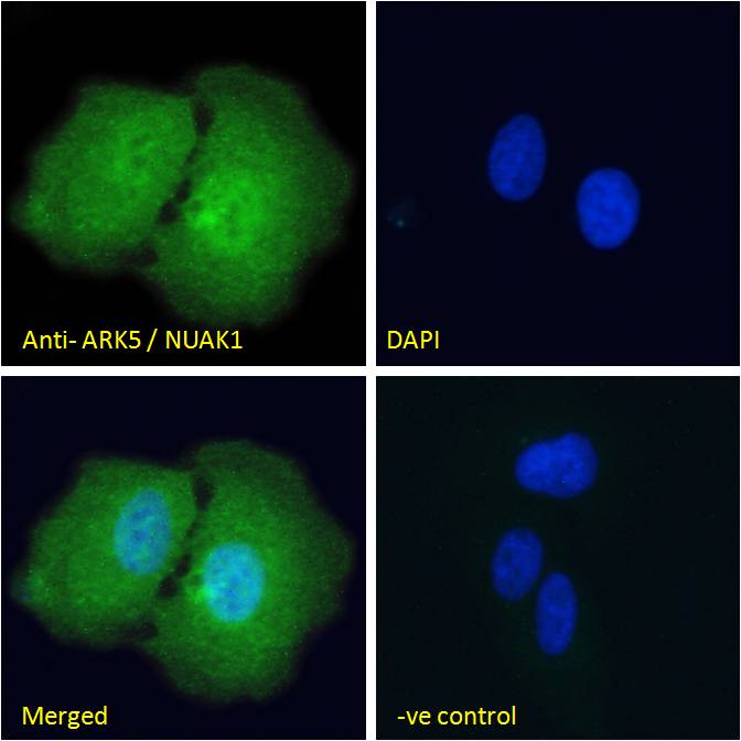 Goat Anti-ARK5 / NUAK1 Antibody