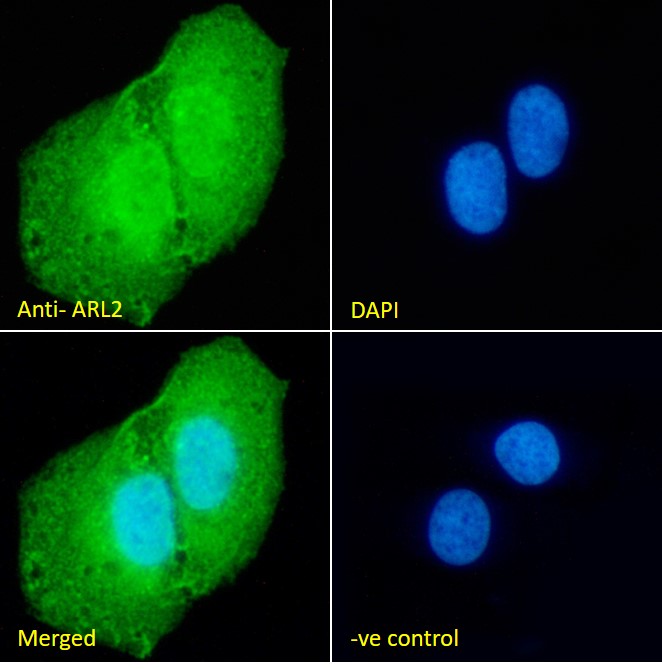 Goat Anti-ARL2 Antibody