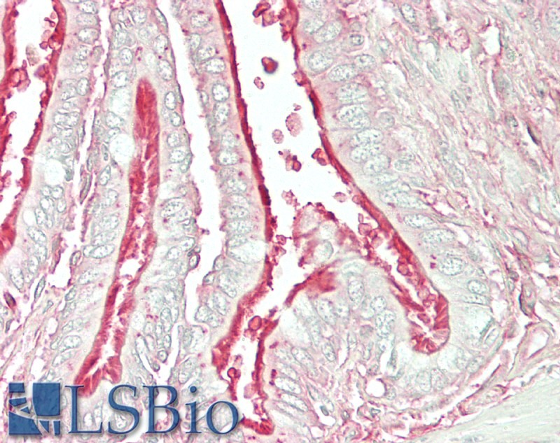 Goat Anti-Arl6 / BBS3 (mouse) Antibody