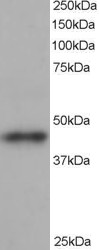 Goat Anti-ARP1 homolog B Antibody