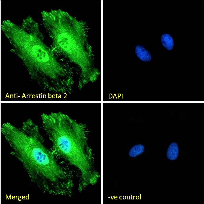 Goat Anti-Arrestin beta 2 Antibody