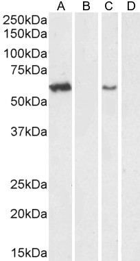 Goat Anti-Arylsulfatase A Antibody