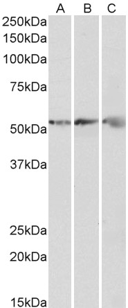 Goat Anti-ATP5B (aa15162) Antibody