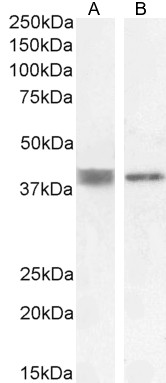 Goat Anti-ATP6IP2 / Renin receptor Antibody
