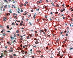 Goat Anti-AXIN1 Antibody